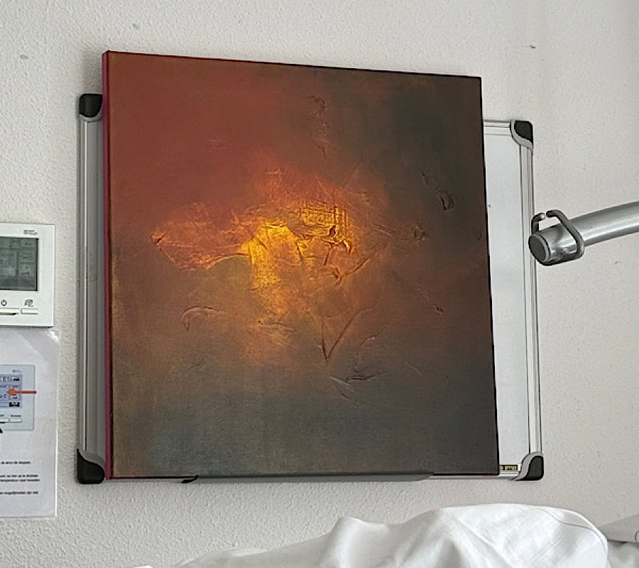 Abstract geel met bruin schilderij Shining Through in revalidatiecentrum